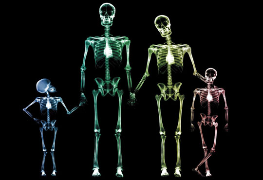 Computed Radiography (Digital X Ray System)