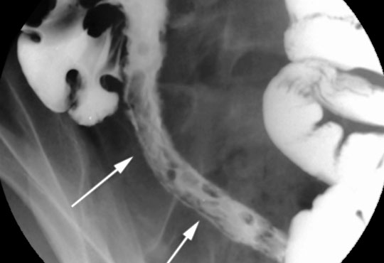 X Ray procedures like IVU and various Dye studies
