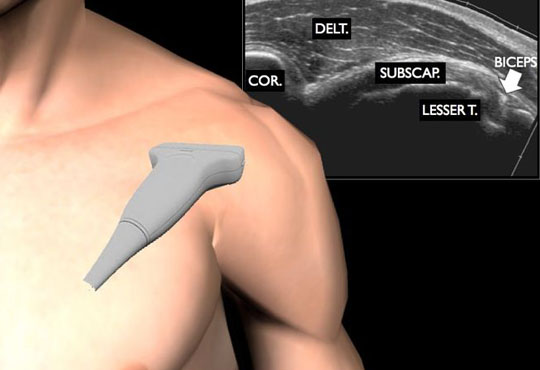 Musculo - Skeletal Ultrasound