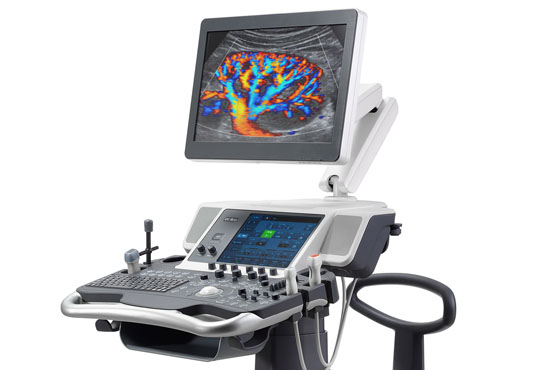Colour Doppler Imaging